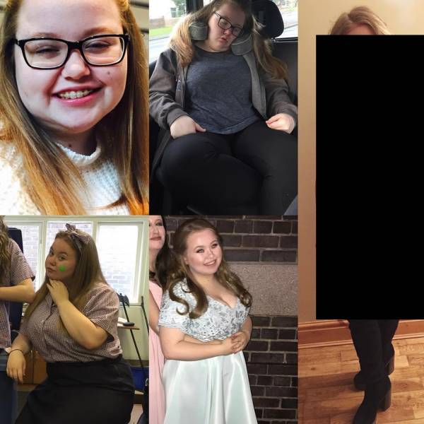 Girl Loses Half Her Weight And Turns Into A Beauty