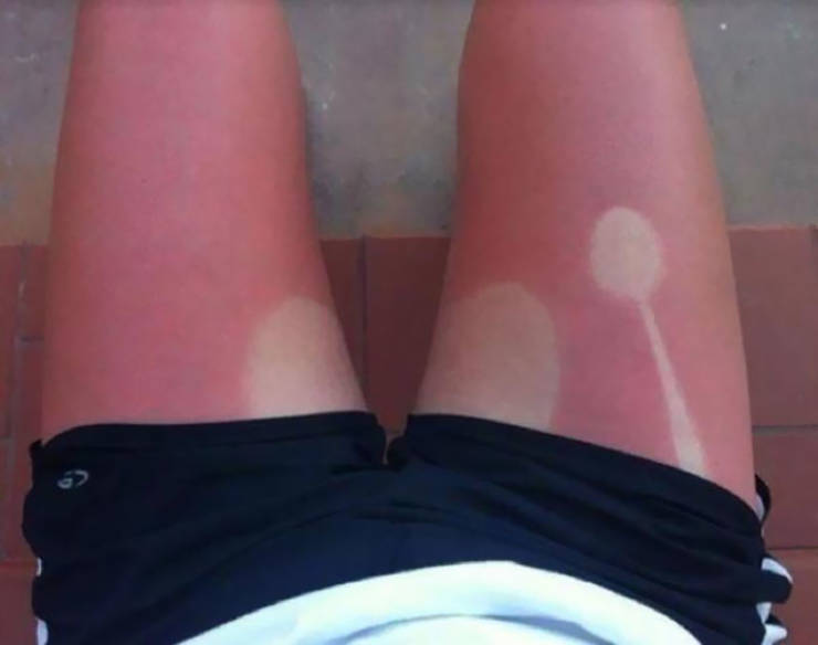 Never Forget Sunscreen!