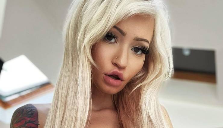 American Woman Enlarged Her Breasts And Became A Millionaire To Spite Her Former Classmates