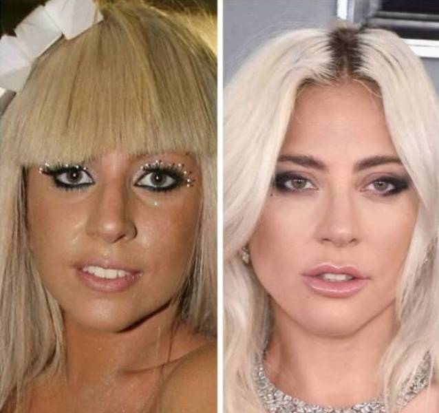 Celebrities: Before And After