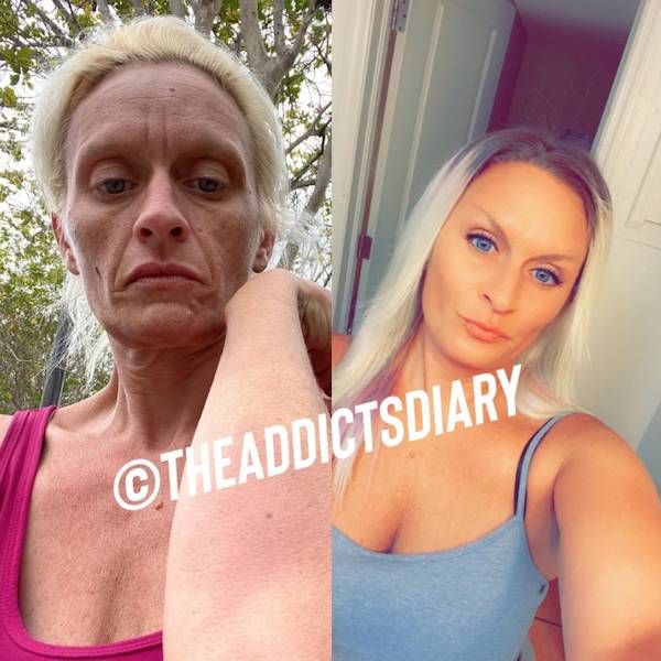 Incredibly Inspiring Drug Addict Transformations!