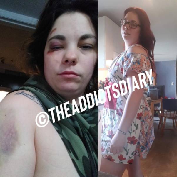 Incredibly Inspiring Drug Addict Transformations!