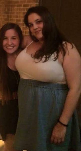 Girl Loses 44 Kilos After Seeing Herself In A Photo