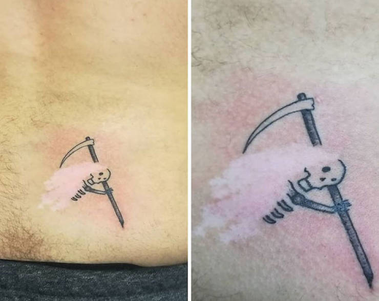 Tattoo Artists Covering Scars And Birthmarks