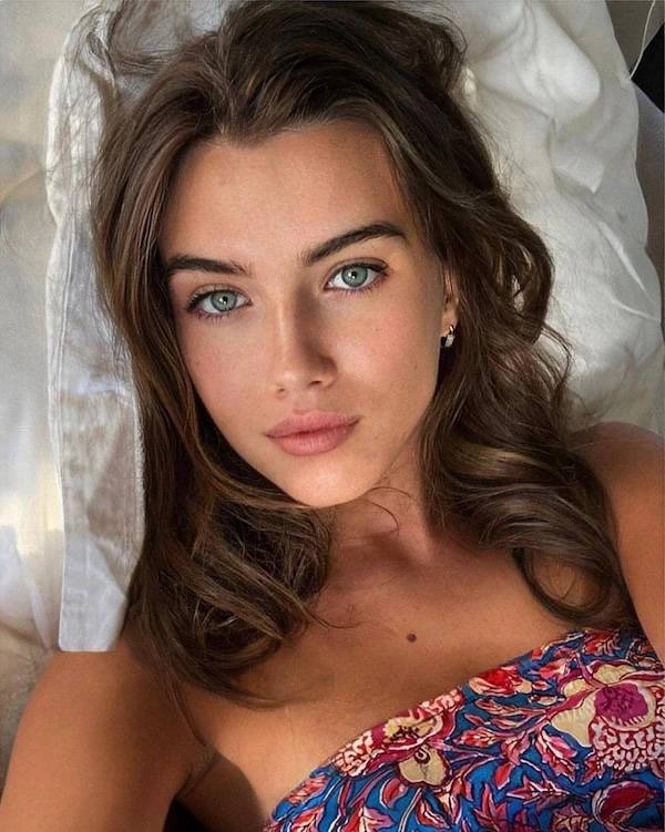 The Charm Of Freckled Faces