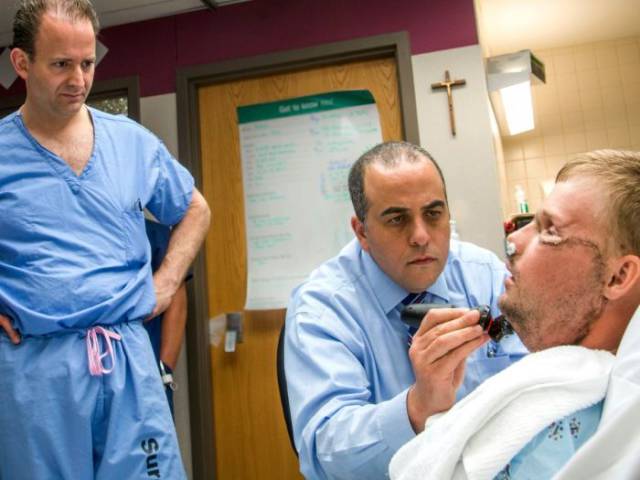 Face Transplantation Is A Thing!