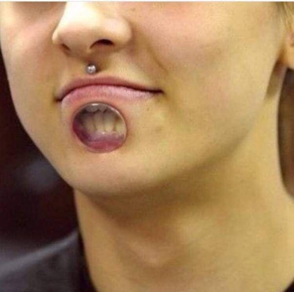 Pictures That Will Make You Cringe