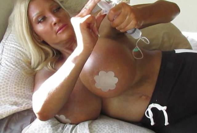 This Model Went Too Far With Her Boob Jobs…