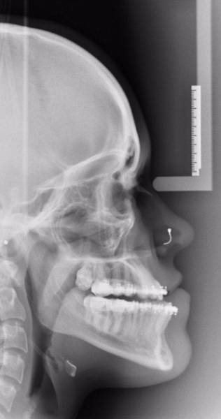 Surgery Didn’t Only Change Her Face – It Changed Her Life