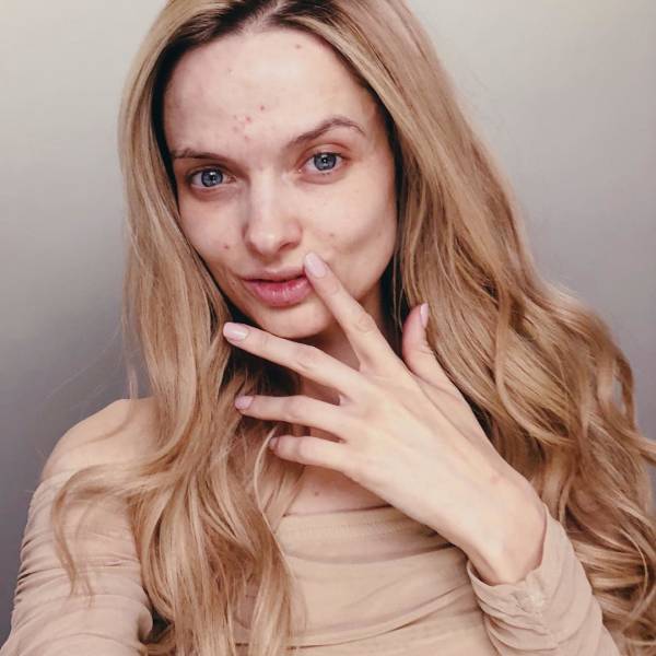 Models Who Are Not Ashamed Of Their Body “Flaws”