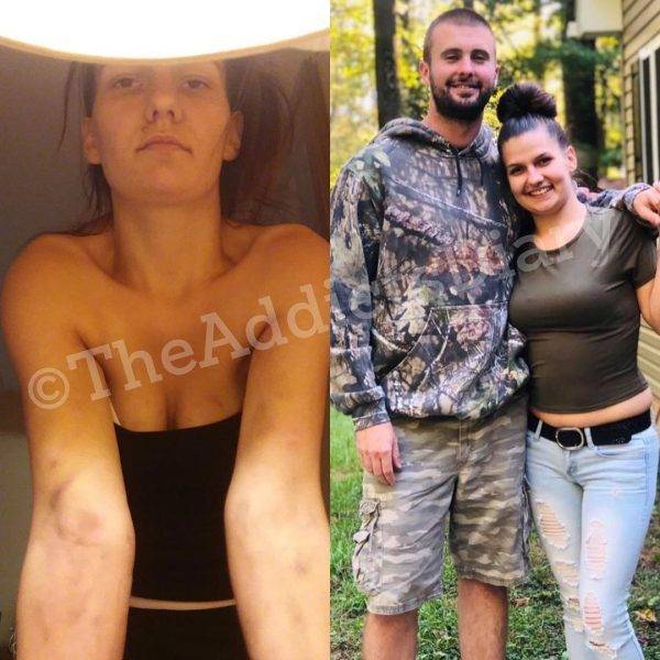 How Drug Addicts Transform After Getting Clean