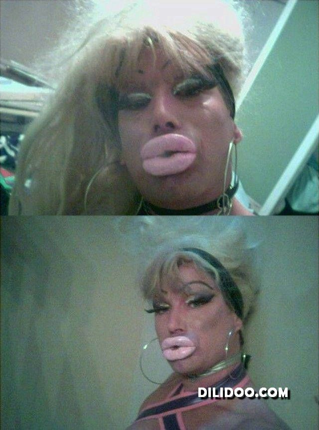 When plastic surgery fails (38 pics)