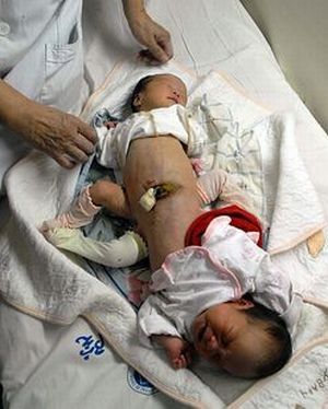 Curiosities and bonus pictures