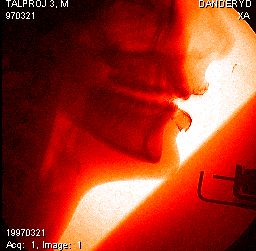 Curiosities and bonus pictures