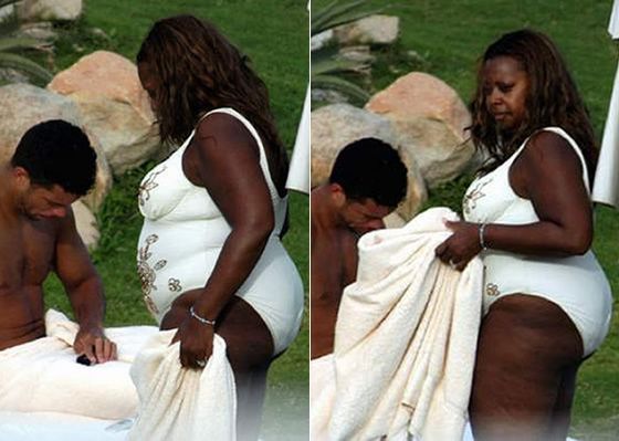 Celebrities and Their Imperfections! (58 pics)