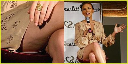 Celebrities and Their Imperfections! (58 pics)