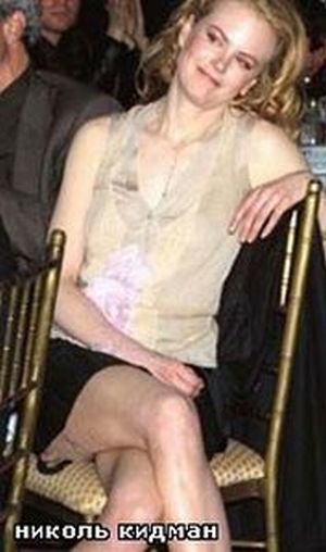 Celebrities and Their Imperfections! (58 pics)