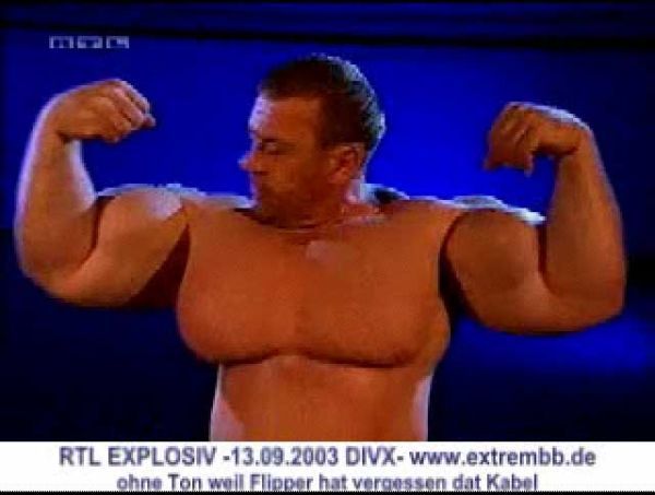 When Synthol Utilisation Goes Wrong! (53 pics)