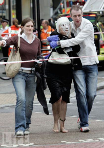 Incredible Healing after a Bomb Explosion (15 pics)