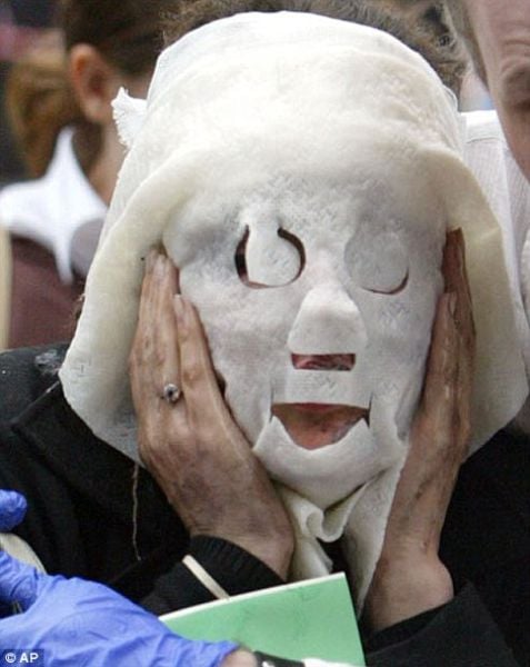 Incredible Healing after a Bomb Explosion (15 pics)