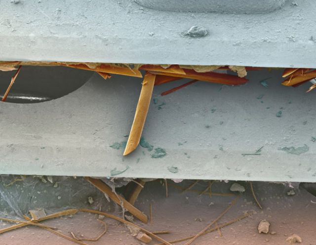 Amazing Scanning Electron Microscope Pictures