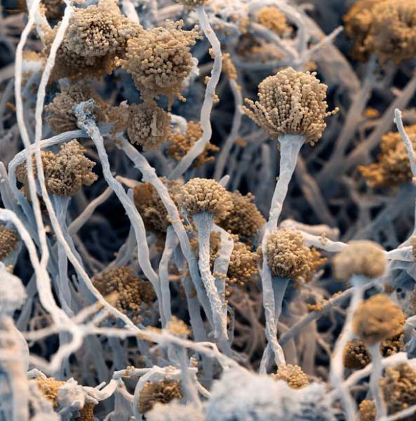 Amazing Scanning Electron Microscope Pictures