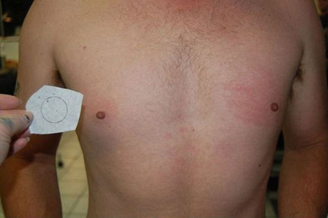 If Your Nipples Are Too Small