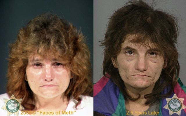 Meth Addicts: Before and After