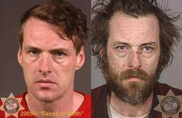 Meth Addicts: Before and After