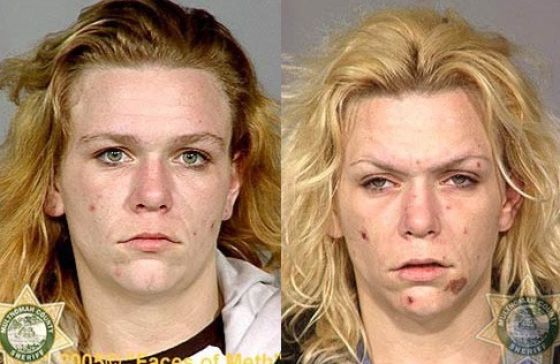 Meth Addicts: Before and After