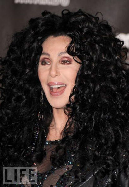 Celebrity Plastic Surgery Before & After