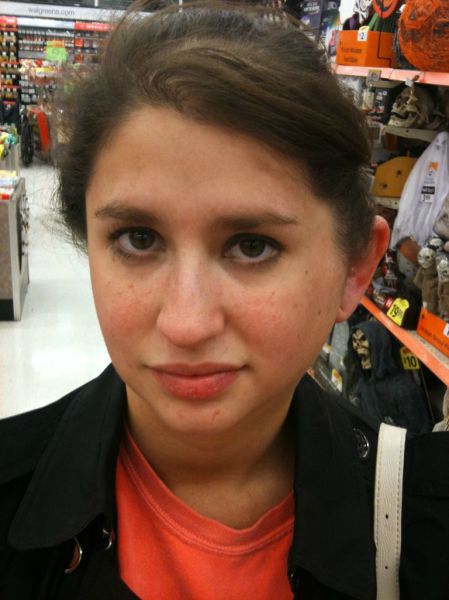 What a Brown Recluse Spider Bite Looks Like