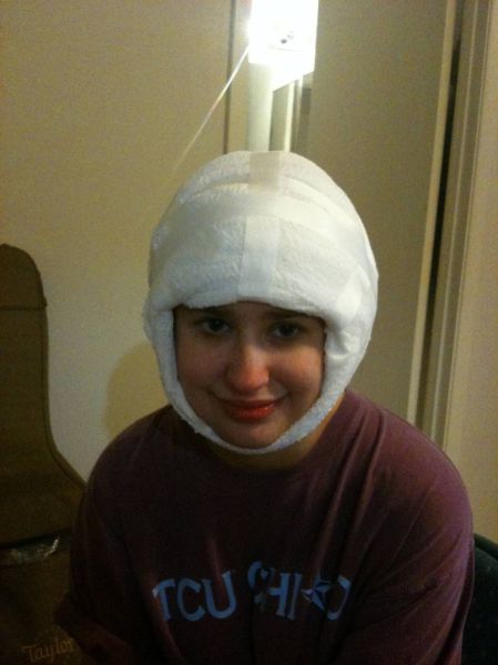 What a Brown Recluse Spider Bite Looks Like