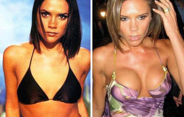 Celebs with the Worst Fake Breasts: Before and After