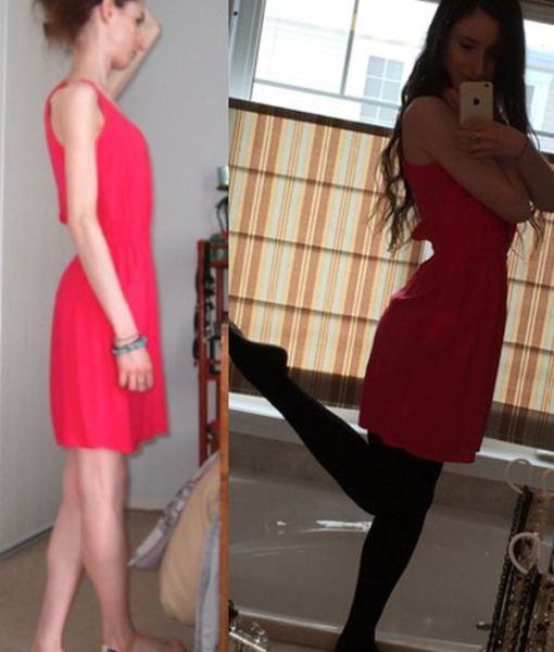 A Drastic Eating Disorder Recovery That Is Truly Amazing