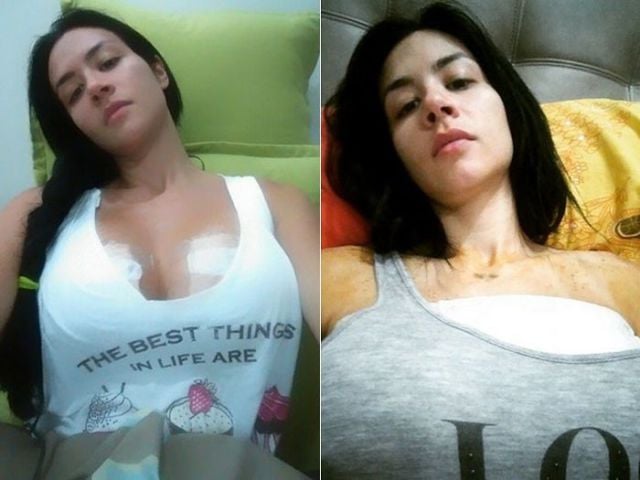 Playboy Model’s Boob Bursts while Pole Dancing