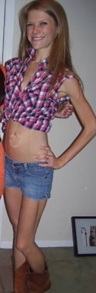 From Anorexia To Binge Eating To A Healthy CrossFit Athlete